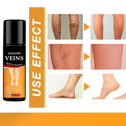 Varicose Veins Care Calming Spray