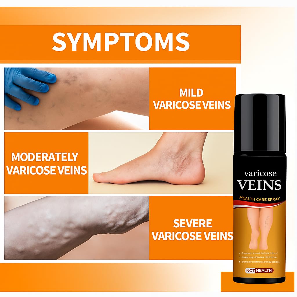 Varicose Veins Care Calming Spray