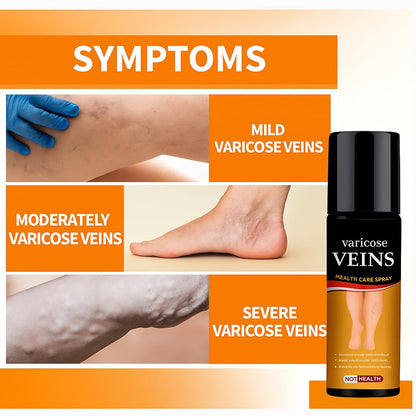 Varicose Veins Care Calming Spray