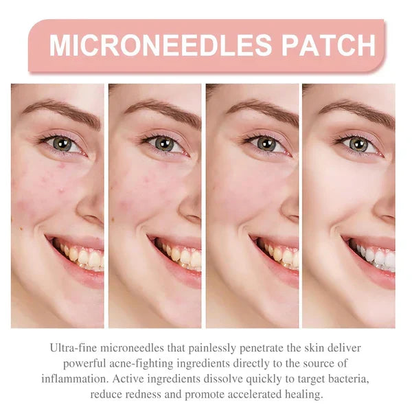 Derma Smooth Skin Tag Removal Patch